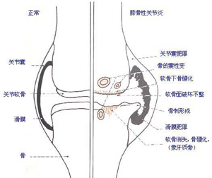 犬骨關節病